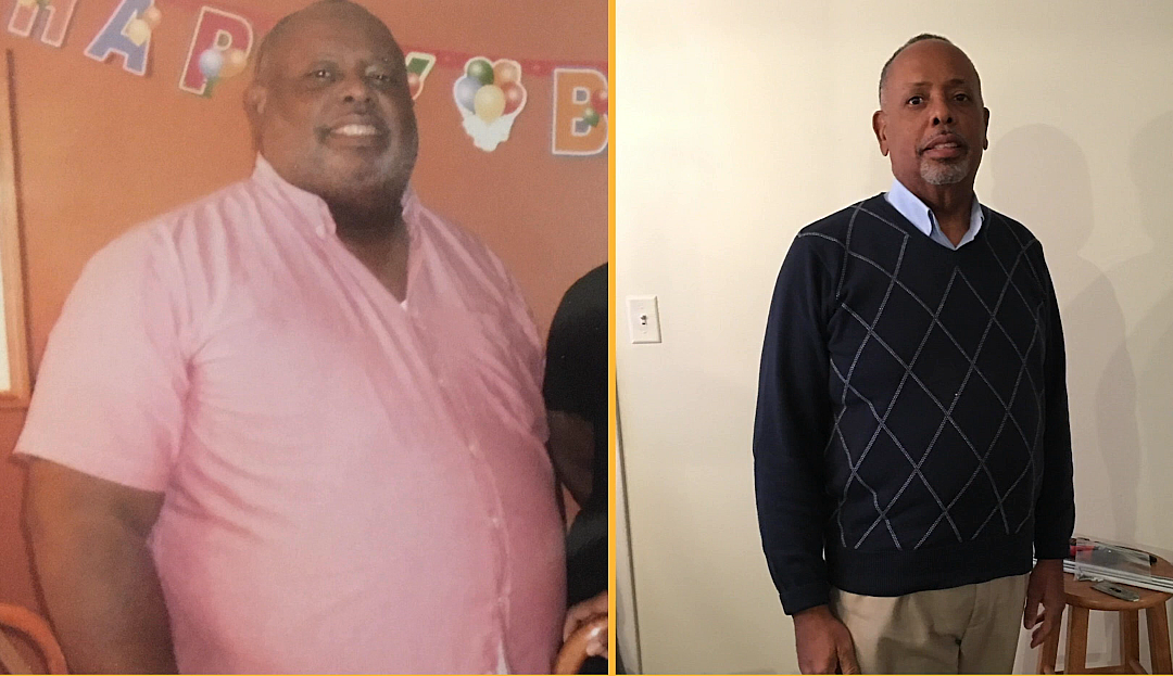 Dr. Paul’s Amazing Ideal Protein Outcome 185lbs lost!
